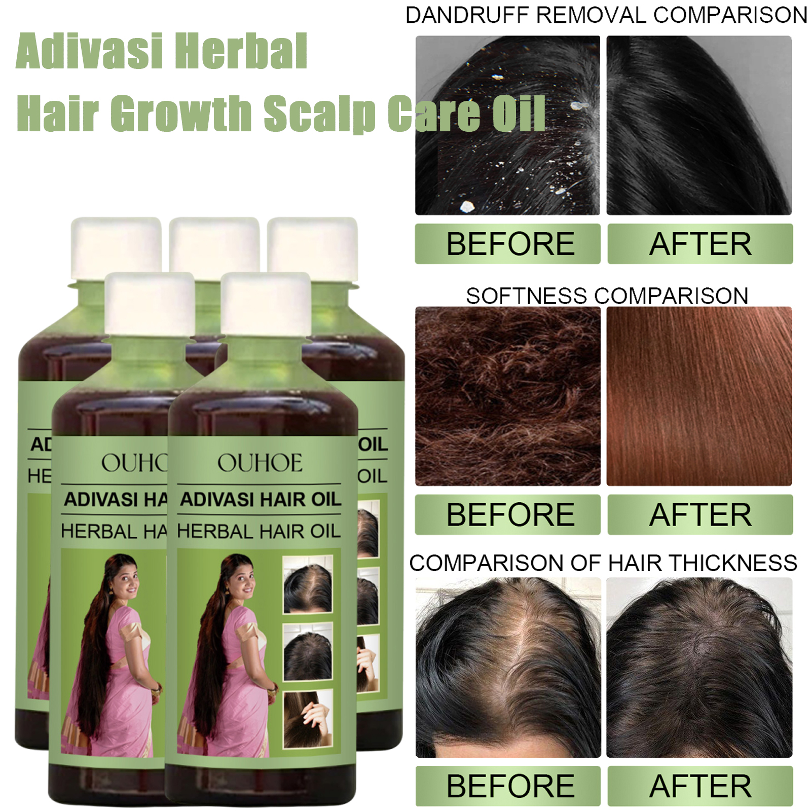 Hair Care India - 100ml Hair Growth Oil India Adivasi