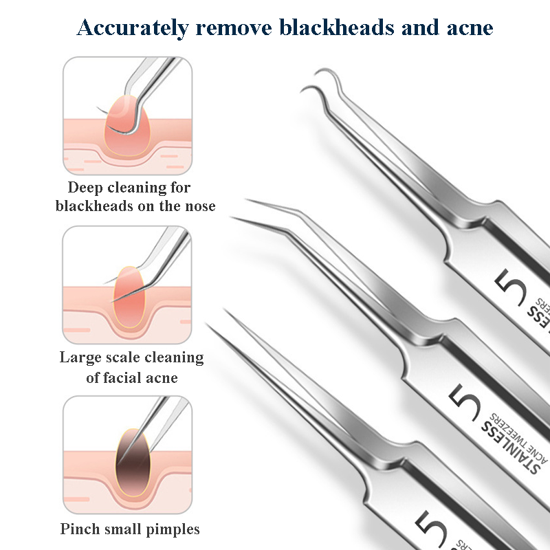 4-11Pcs Ingrown Hair Tweezers  – Hair Care Clinic Bewertung und Preis