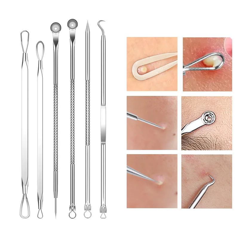 4-11Pcs Ingrown Hair Tweezers  – Hair Care Clinic Bewertung und Preis