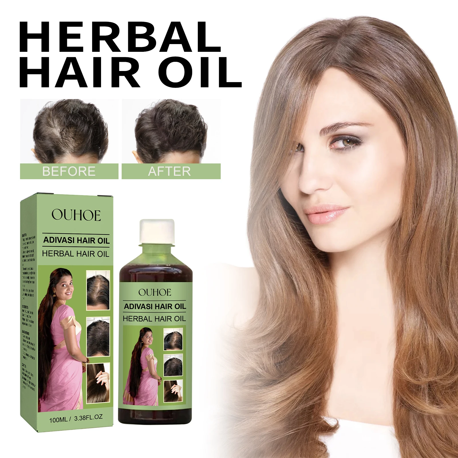 100ml Hair Growth Essential Oi – Hair Care India Bewertung und Preis