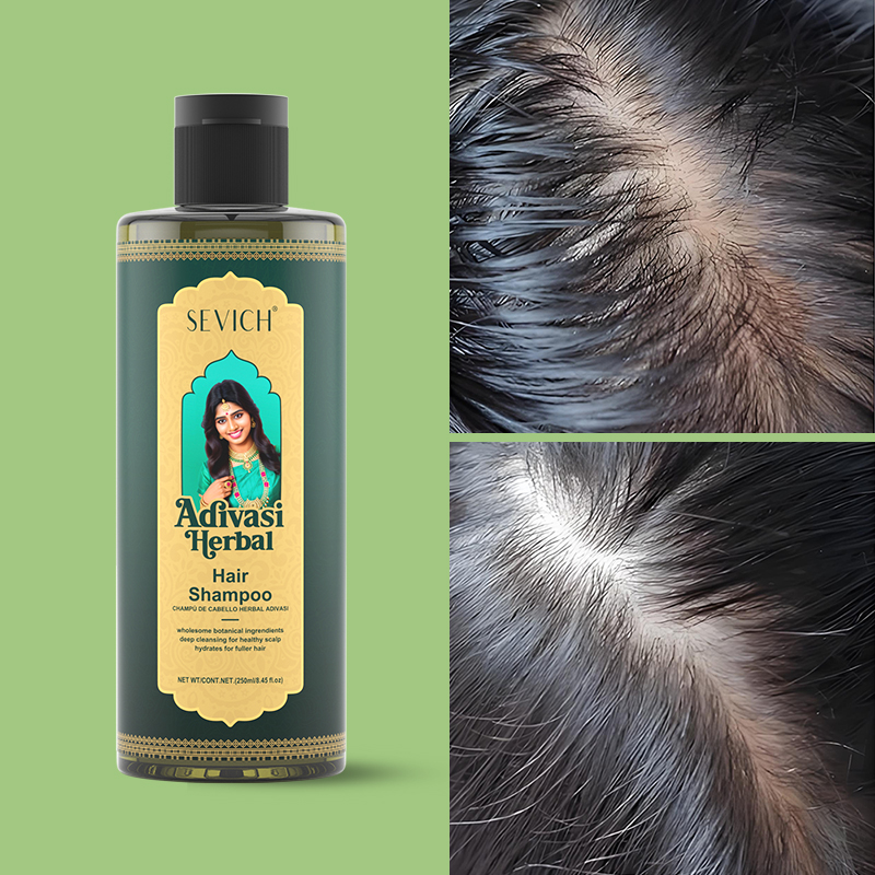 Hair Growth Oil Set Rosemary H – Hair Care India Bewertung und Preis